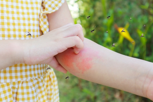 Le conseil pour les piqûres et petits bobos pendant les vacances